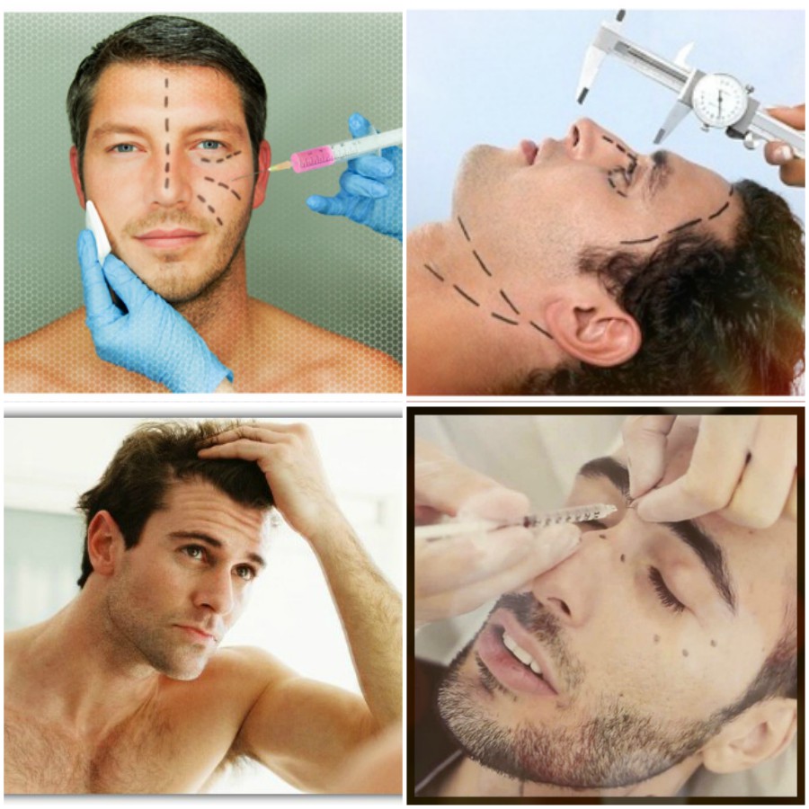 Botox- MEN Collage